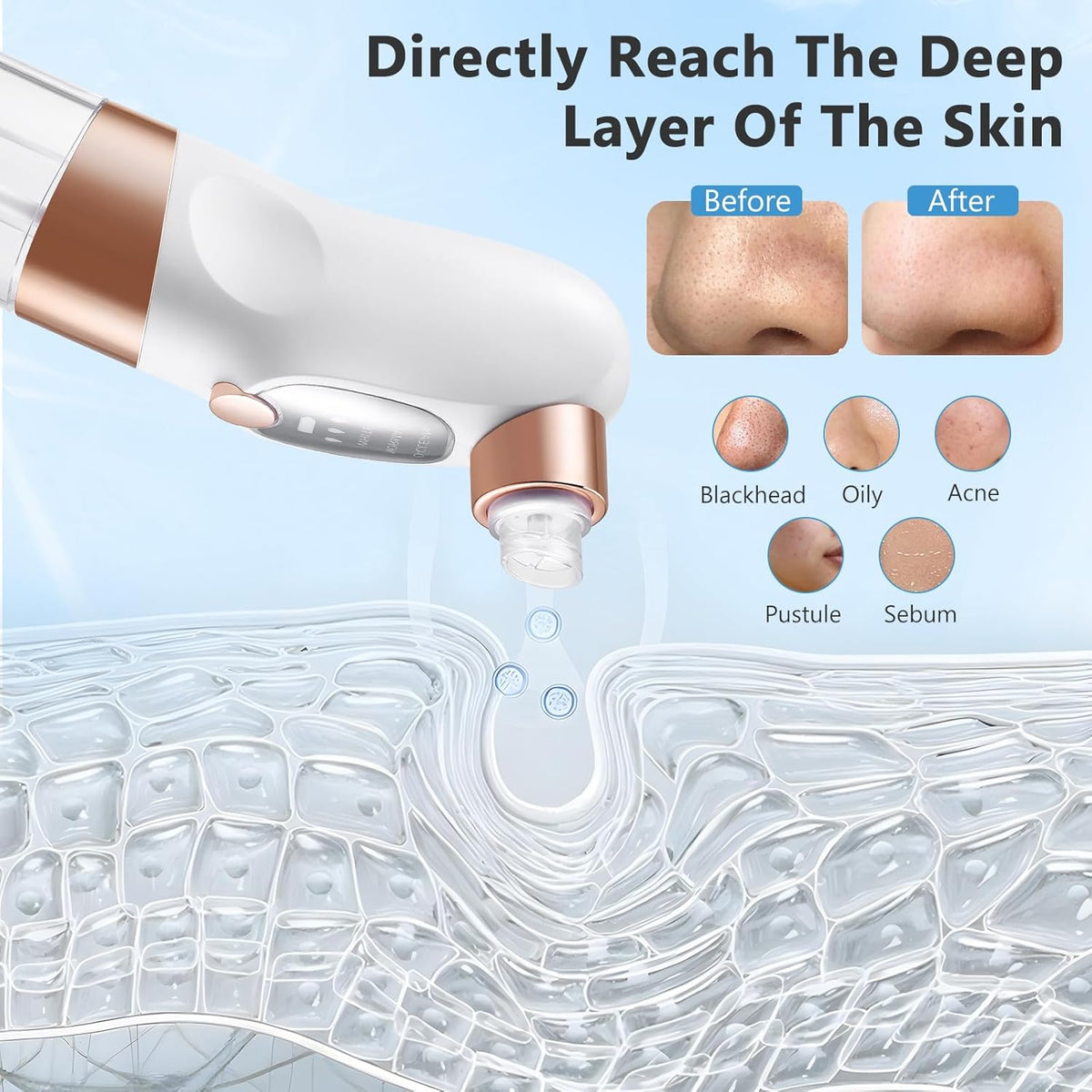 Super Micro Bubble Beauty Instrument – Electric Blackhead Remover & Facial Pore Cleaner with Vacuum Suction