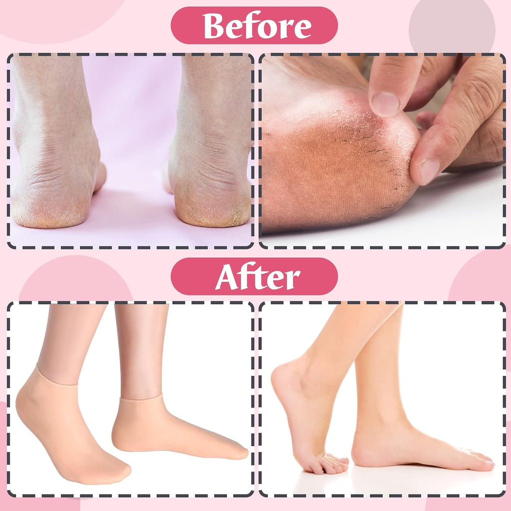 Silicone Moisturizing Foot Socks for Women – Soft Gel Heel Socks for Dry, Cracked Feet & Heel Care